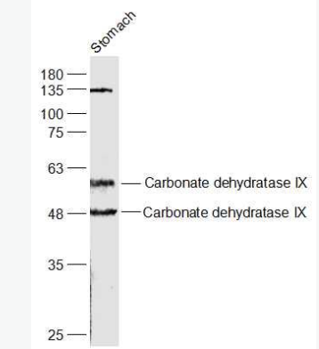 Anti-CA9 antibody-碳酸酐酶9抗体,CA9