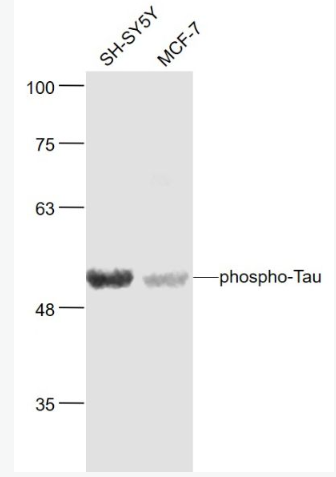 Anti-phospho-Tau (Ser404) antibody-磷酸化微管相关蛋白抗体,phospho-Tau (Ser404)