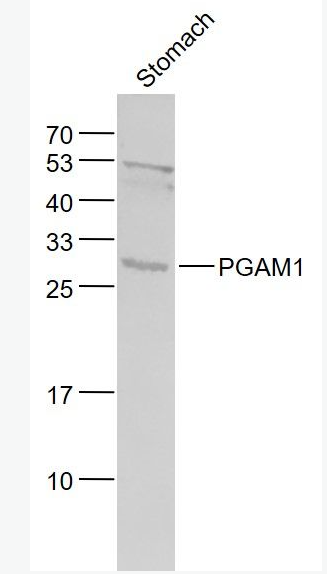 Anti-PGAM1 antibody-磷酸变位酶1抗体,PGAM1