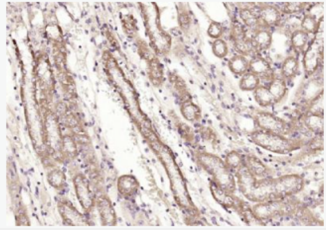 Anti-PFKM/PFK1 antibody-肌肉型6磷酸果糖激酶/磷酸果糖激酶1抗體,PFKM/PFK1