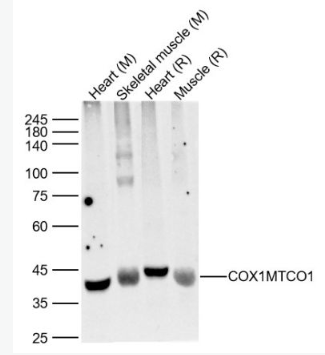 Anti-COX1/MTCO1  antibody-细胞色素c氧化酶1抗体,COX1/MTCO1