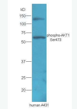 Anti-phospho-AKT1 (Ser473) antibody-磷酸化蛋白激酶AKT1抗体,phospho-AKT1 (Ser473)