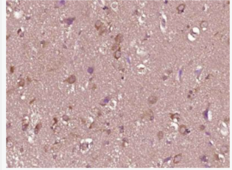 Anti-Phospho-Serine/Threonine antibody-磷酸化絲氨酸/蘇氨酸抗體,Phospho-Serine/Threonine