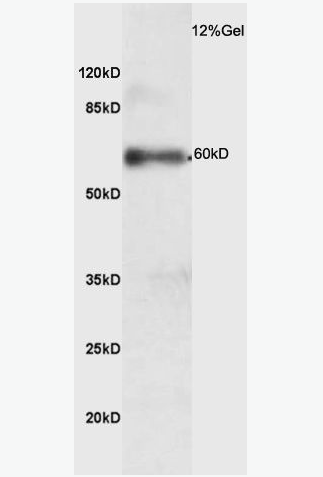 Anti-phospho-IRAK4 (Thr345) antibody-磷酸化白介素-1受體相關激酶4抗體,phospho-IRAK4 (Thr345)