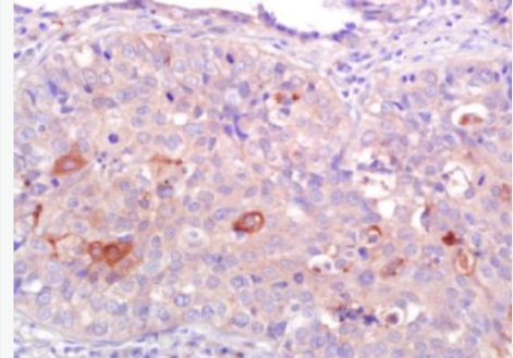 Anti-CNR2 antibody-鈣粘蛋白相關的神經受體2抗體,CNR2