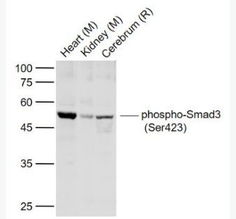 Anti-phospho-Smad3 (Ser423) antibody-磷酸化细胞信号转导分子SMAD3抗体,phospho-Smad3 (Ser423)