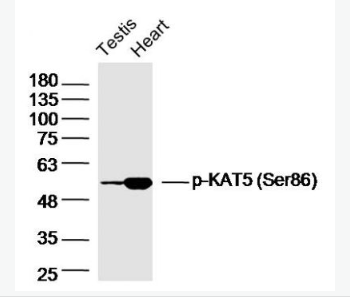 Anti-phospho-KAT5 (Ser86)  antibody-磷酸化組蛋白乙酰轉移酶KAT5抗體,phospho-KAT5 (Ser86)