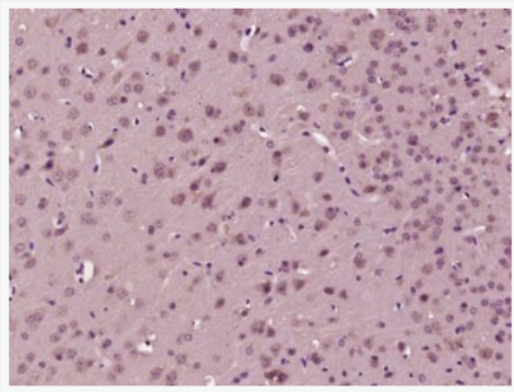 Anti-pphospho-IRS1 (Ser323)  antibody-磷酸化胰岛素受体底物1抗体,phospho-IRS1 (Ser323)