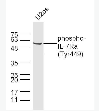 Anti-pphospho-IL7R (Tyr449) antibody-磷酸化白细胞介素-7受体a（CD127）抗体,phospho-IL7R (Tyr449)