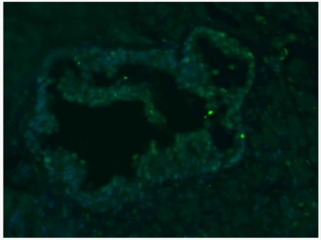 Anti-PLCZ1 antibody-磷酸肌醇磷脂酶PLCZ1抗體,PLCZ1