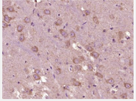 Anti-phospho-DDIT3 (Ser30)  antibody-磷酸化GADD153抗体,phospho-DDIT3 (Ser30)