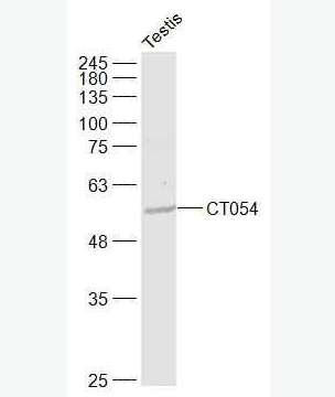 Anti-CT054 antibody-核黄素转运蛋白2抗体,CT054