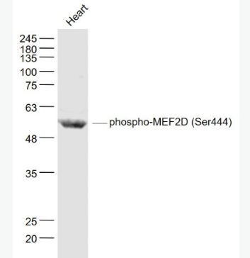 Anti-phospho-MEF2D (Ser444)  antibody-磷酸化肌細(xì)胞特異性增強(qiáng)因子2D抗體,phospho-MEF2D (Ser444)