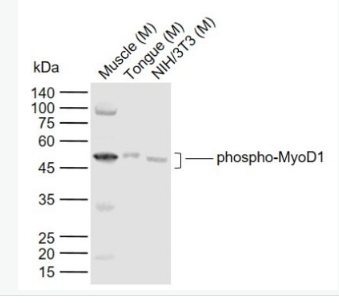 Anti-phospho-MyoD1 (Ser200)  antibody-磷酸化肌原调节蛋白抗体,phospho-MyoD1 (Ser200)