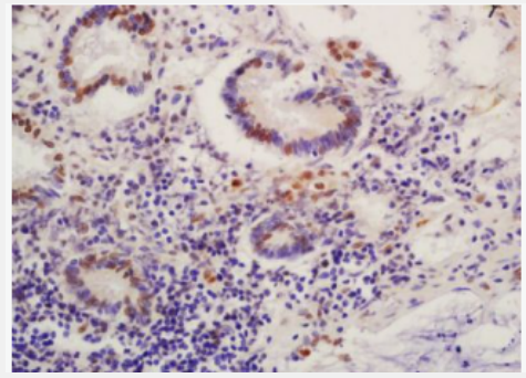 Anti-Phospho-MDM2 (Ser186)  antibody-磷酸化双微体2癌基因抗体,Phospho-MDM2 (Ser186)