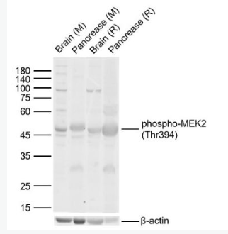 Anti-phospho-MEK2 (Thr394)  antibody-磷酸化丝裂原活化蛋白激酶激酶2抗体,phospho-MEK2 (Thr394)