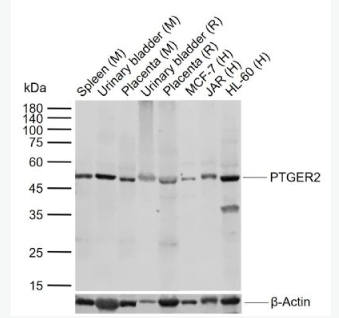 Anti-PTGER2 antibody-前列腺素E2受体2抗体,PTGER2