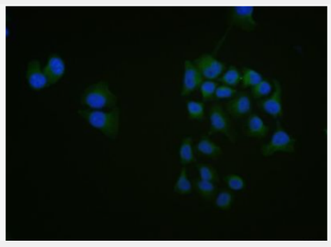 Anti-phospho-RAC1 + RAC2 (Ser71) antibody-磷酸化细胞迁移诱导因子5抗体,phospho-RAC1 + RAC2 (Ser71)