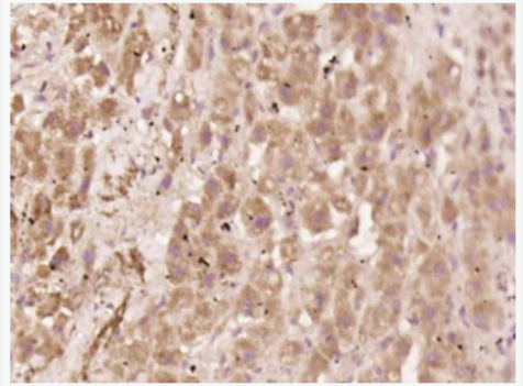 Anti-phospho-NFKB p65 (Ser529) antibody-磷酸化细胞核因子抗体,phospho-NFKB p65 (Ser529)