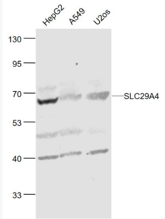 Anti-SLC29A4 antibody-脑质膜单胺转运蛋白PMAT抗体,SLC29A4