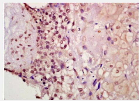 Anti-Phospho-Smad2 (Thr220) antibody-磷酸化細胞信號轉(zhuǎn)導(dǎo)分子SMAD2抗體,Phospho-Smad2 (Thr220)