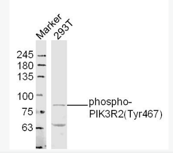 Anti-pphospho-PIK3R2 (Tyr467)  antibody-磷酸化磷脂酰肌醇激酶p85β抗体,phospho-PIK3R2 (Tyr467)