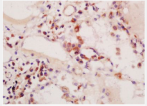 Anti-phospho-PIK3C3 (Ser164)  antibody-磷酸化磷脂酰肌醇激酶3催化亚单位3抗体,phospho-PIK3C3 (Ser164)