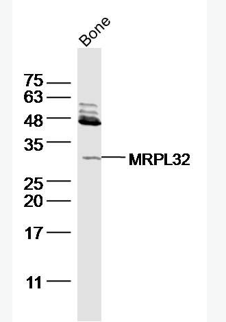 Anti-FGF23  antibody-成纤维细胞生长因子23抗体,FGF23