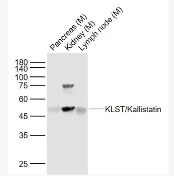 Anti-KLST/Kallistatin antibody-激肽釋放酶抑制劑抗體,KLST/Kallistatin