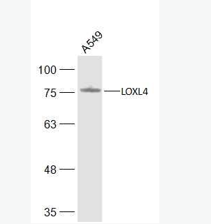 Anti-LOXL4 antibody-赖氨酰氧化酶样蛋白4抗体,LOXL4