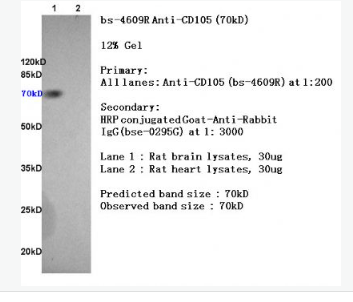 Anti-CD105 antibody-内皮糖蛋白抗体,CD105