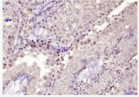 Anti-PCGF1 antibody-表观抑制因子Polycomb家族成员PCGFl蛋白抗体,PCGF1