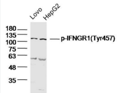 Anti-Phospho-Insulin Receptor (Tyr999)   antibody-磷酸化胰岛素受体抗体,Phospho-Insulin Receptor (Tyr999)
