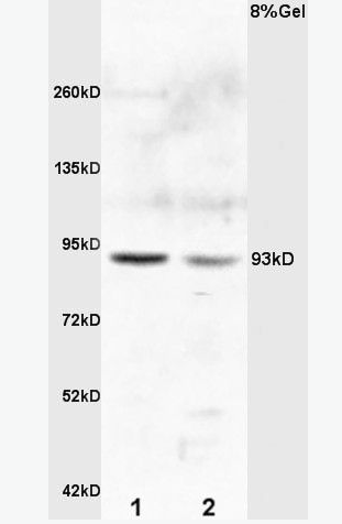Anti-E2F8  antibody-转录因子E2F8抗体,E2F8