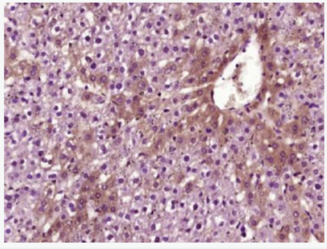 Anti-VEGFA antibody-血管内皮生长因子A,VEGFA