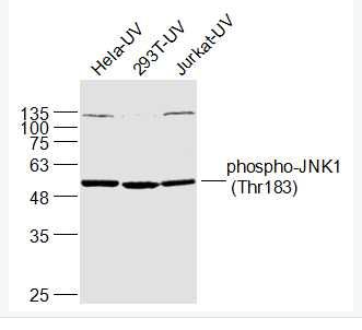 Anti-phospho-JNK1 (Thr183) antibody-磷酸化氨基末端激酶1抗体,phospho-JNK1 (Thr183)