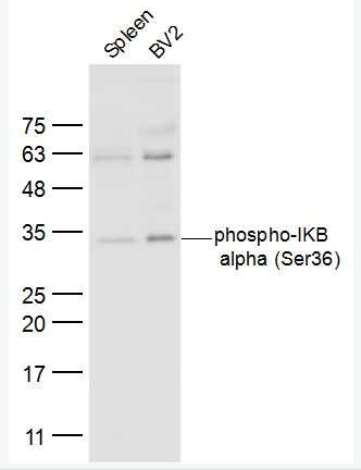 Anti-phphospho-IKB alpha (Ser36)  antibody-磷酸化核因子κB抑制蛋白α抗体体,phospho-IKB alpha (Ser36)
