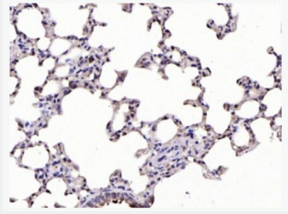 Anti-phospho-IKB alpha (Ser32)  antibody-磷酸化核因子κB抑制蛋白α抗体,phospho-IKB alpha (Ser32)