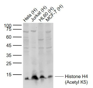 Anti-Histone H4 (Acetyl K5) antibody-乙?；M蛋白H4抗體,Histone H4 (Acetyl K5)