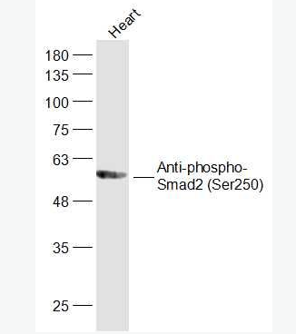 Anti-phospho-Smad2 (Ser250) antibody-磷酸化细胞信号转导分子SMAD2抗体,phospho-Smad2 (Ser250)