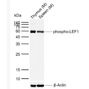 Anti-phospho-LEF1 (Ser42) antibody-磷酸化淋巴增强因子-1抗体