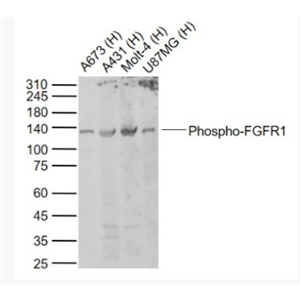 Anti-Phospho-FGFR1 (Tyr154) antibody-磷酸化碱性成纤维细胞生长因子受体1（CD331）抗体