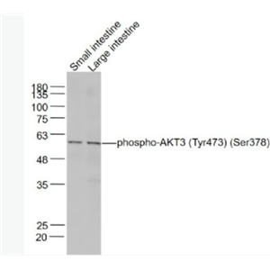 Anti-phospho-AKT3 (Tyr473) antibody-磷酸化蛋白激酶B抗体