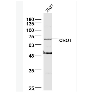 Anti-CROT antibody-肉碱氧位甲基转移酶抗体