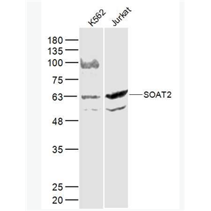 Anti-SOAT2 antibody-胆固醇酰基转移酶2抗体