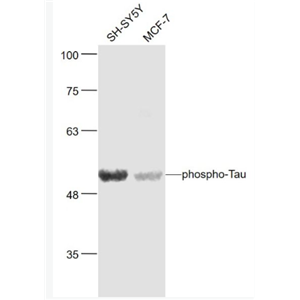 Anti-phospho-Tau (Ser404) antibody-磷酸化微管相关蛋白抗体,phospho-Tau (Ser404)
