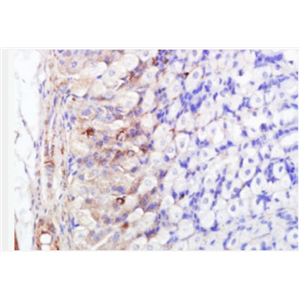 Anti-FABP5 antibody-脂肪酸结合蛋白5/上皮细胞型抗体