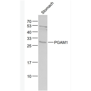 Anti-PGAM1 antibody-磷酸变位酶1抗体