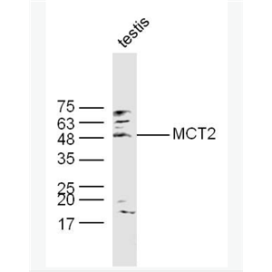 Anti-MCT2  antibody-单羧酸转运蛋白2抗体