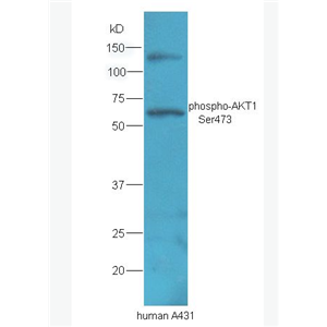 Anti-phospho-AKT1 (Ser473) antibody-磷酸化蛋白激酶AKT1抗体
